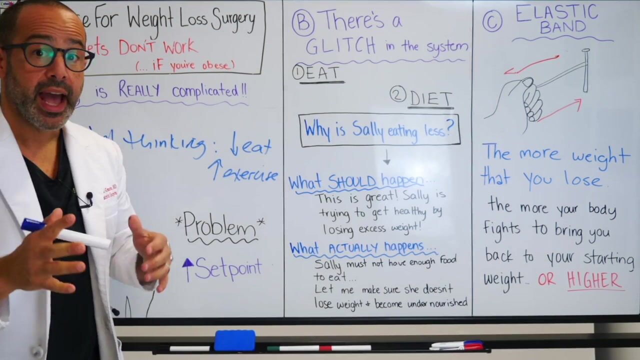 Sleeve School Part 1 - Why Diets Don’t Work? — video still 4