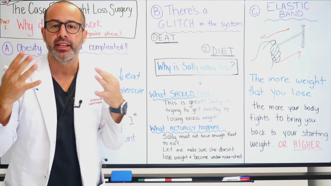 Sleeve School Part 1 - Why Diets Don’t Work? — video still 4